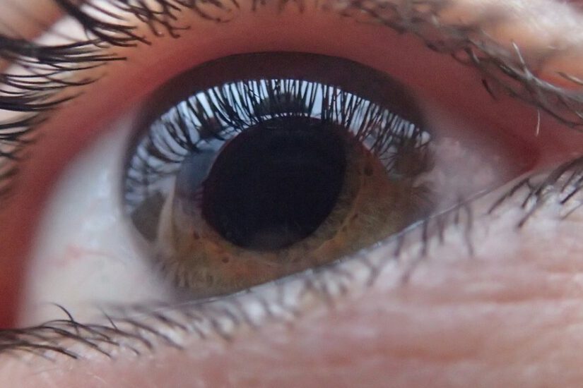 Choroby oczu i ich leczenie ziołami